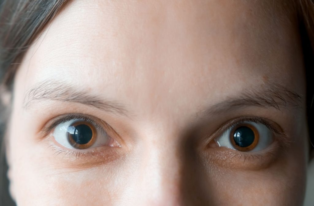 A close-up of a woman's brown eyes with dilated pupils for an eye exam