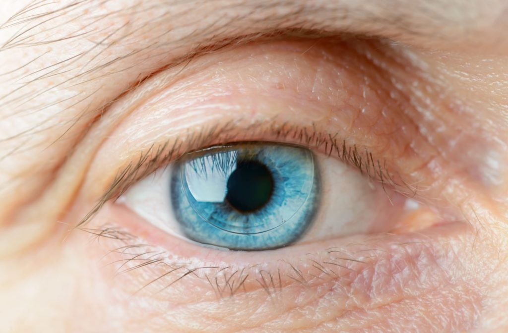 A close-up blue eye of a person wearing a hard contact lens